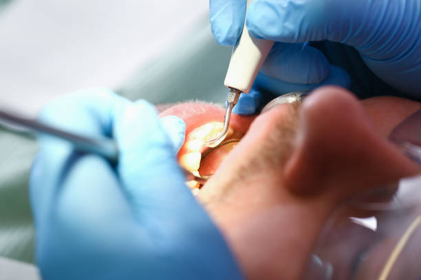 Best Pediatric Emergency Dentist in Fremont, CA